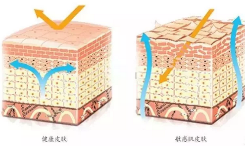 敏感肌膚與健康肌膚的對(duì)比 敏感肌膚與健康肌膚的對(duì)比,導(dǎo)致肌膚敏感的原因有哪些
