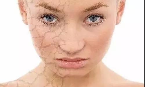 肌膚干裂 肌膚刺癢是什么原因?是哪些因素造成肌膚刺癢的現象?