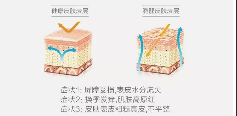 敏感肌表皮層 敏感肌表皮層