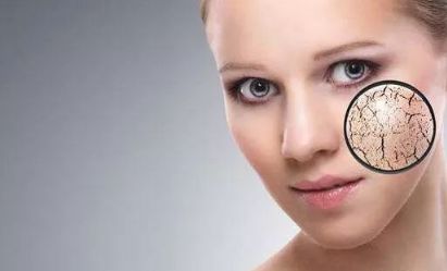 干性皮膚 不同膚質(zhì)應該如何正確護膚?