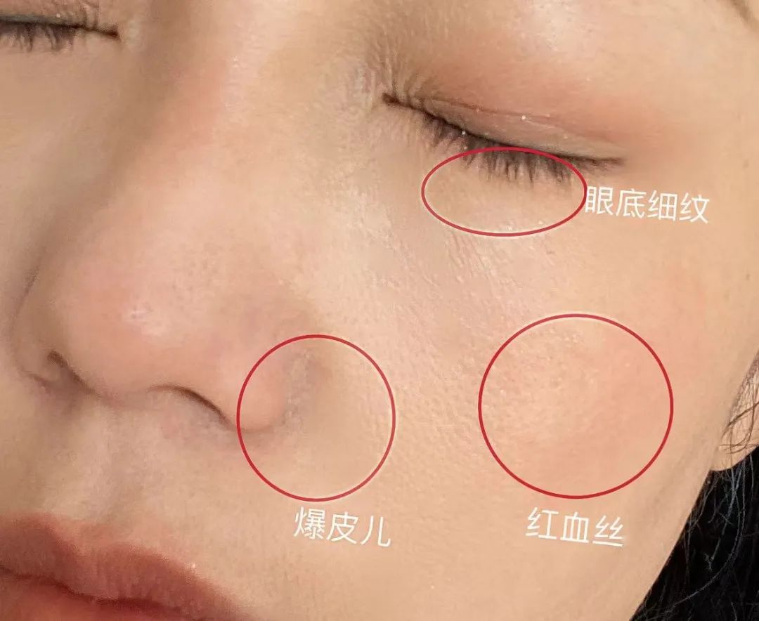 干敏肌膚 如何判斷自己是不是干敏肌膚?干敏肌有哪些特征?