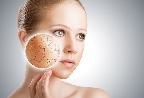 皮膚缺水的癥狀表現有哪些 皮膚缺水的表現有哪些?肌膚缺水有什么癥狀?