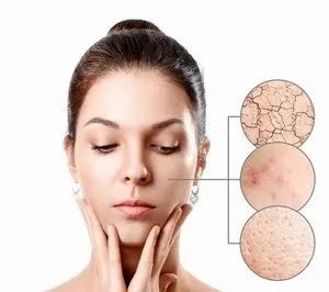 春敏是什么? 什么是春敏?如何預(yù)防春敏?