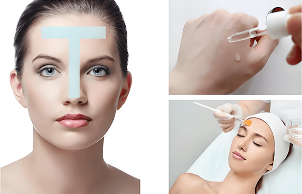 刷酸 什么是刷酸?刷酸有什么好處?刷酸的好處有哪些?