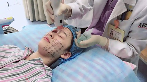 熱瑪吉美容項目 熱瑪吉有什么效果和副作用?