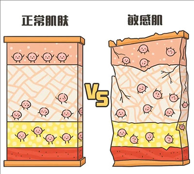 敏感性皮膚和正常皮膚 敏感性皮膚產(chǎn)生的原因是什么?