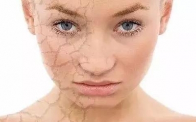 肌膚刺癢是什么原因？是哪些因素造成肌膚刺癢的現(xiàn)象？