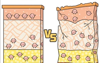 敏感性皮膚產生的原因是什么？